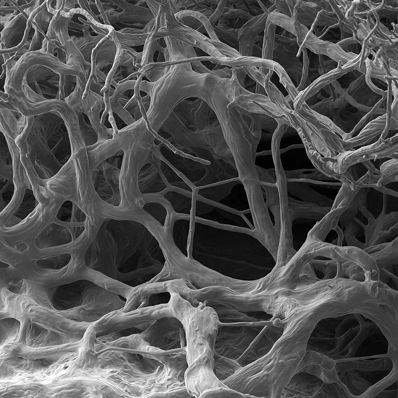 Mold on bread. SEM image. FoV (Field of Vision) 322 µm